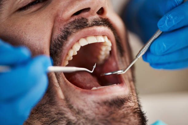 Sedation Dentistry in Creswell, OR